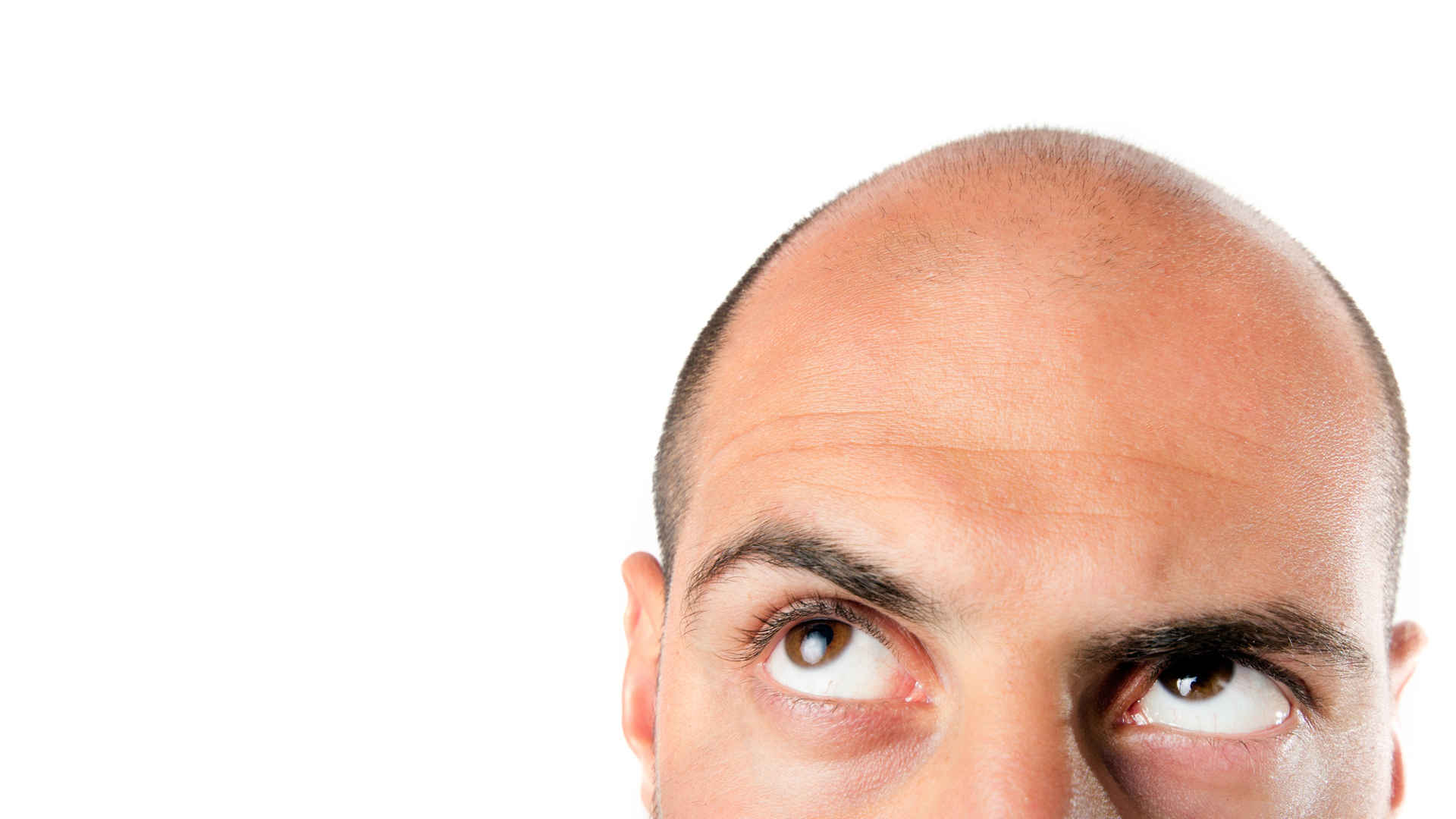 Ratgeber Haartransplantation