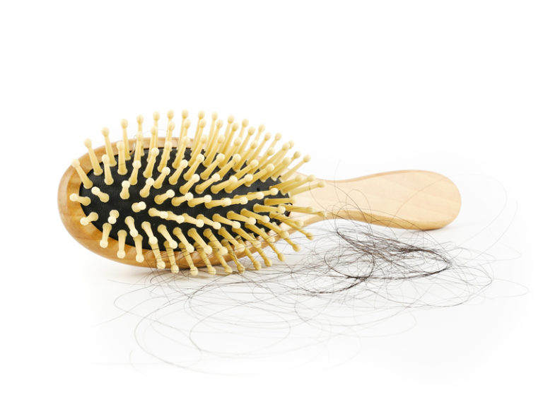 Ursachen für Haarausfall | Ausgekämmte Haare an einer Bürste