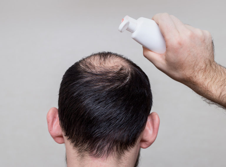 Shampoo gegen Haarausfall
