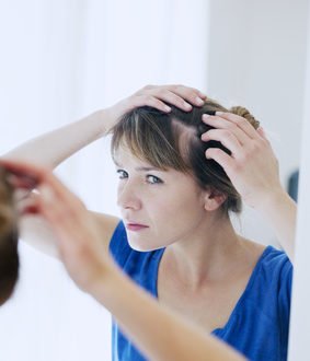 Kreisrunder Haarausfall bei Frauen